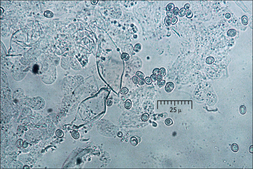 Image of Pluteus pouzarianus Singer 1983