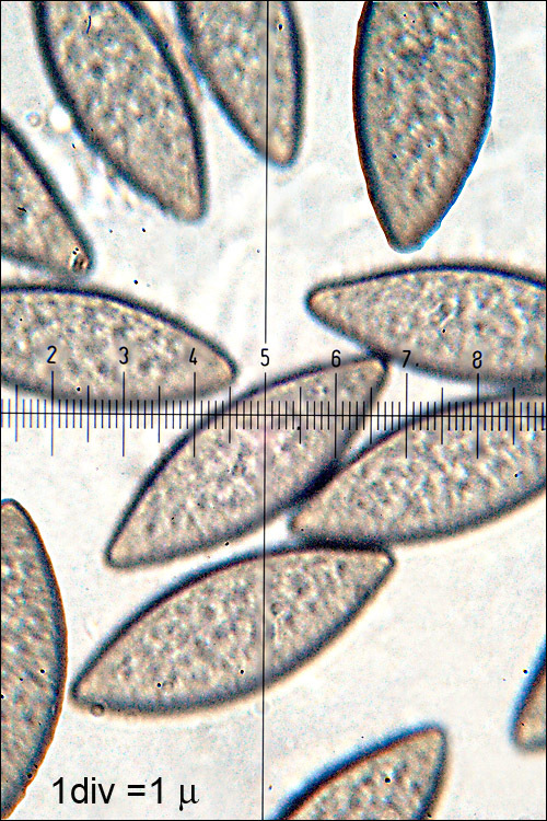 Image of Spinellus fusiger (Link) Tiegh. 1875