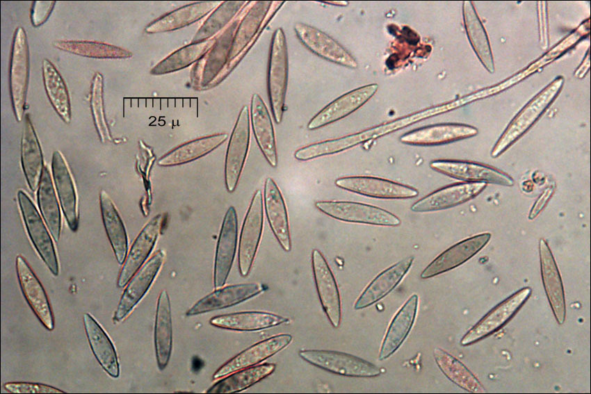 Image of Lachnellula splendens (J. Schröt.) Baral & Matheis 2000