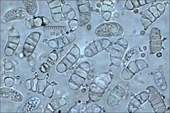 Слика од Guepiniopsis buccina (Pers.) L. L. Kenn. 1959