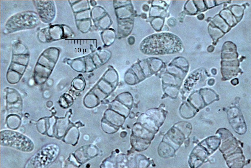 Image of Guepiniopsis buccina (Pers.) L. L. Kenn. 1959