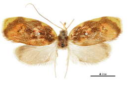 Image of Hypercallia