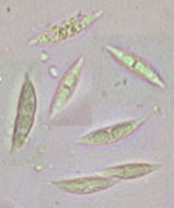 Image of Hypomyces aurantius (Pers.) Fuckel 1870