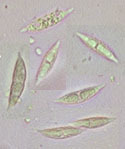 Image of Hypomyces aurantius (Pers.) Fuckel 1870