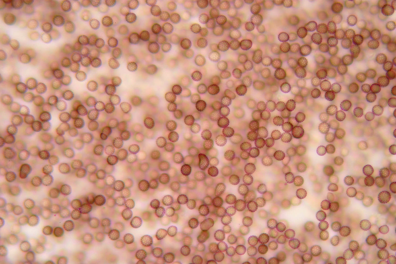 Image of Microbotryum silenes-dioicae T. Giraud, Denchev & M. E. Hood 2009