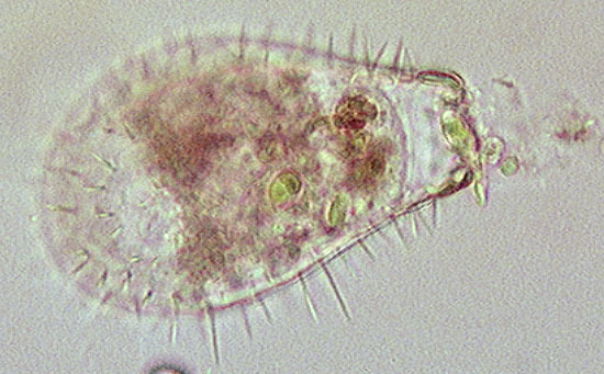 Image of <i>Euglypha ciliata</i>