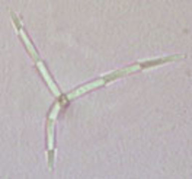 Image of <i>Alatospora acuminata</i> Ingold 1942