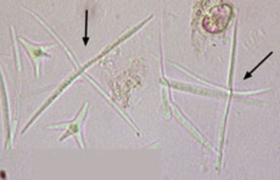 Image of <i>Alatospora acuminata</i> Ingold 1942