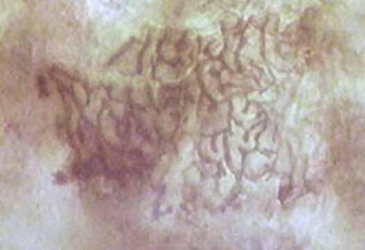 Image of <i>Coleroa robertiani</i> (Fr.) E. Müll. 1962