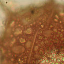 Image of <i>Centropyxis aculatea</i>
