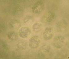 Image of <i>Coelosphaerium kuetzingianum</i> Naegeli 1849