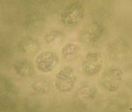 Image of <i>Coelosphaerium kuetzingianum</i> Naegeli 1849
