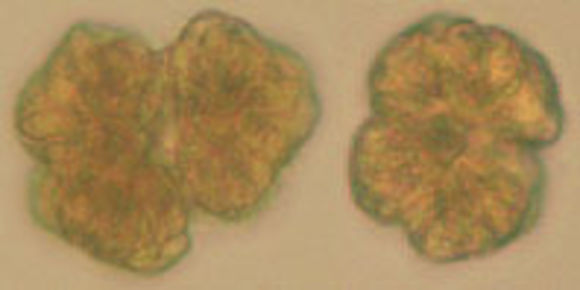 Image of Botryococcus braunii
