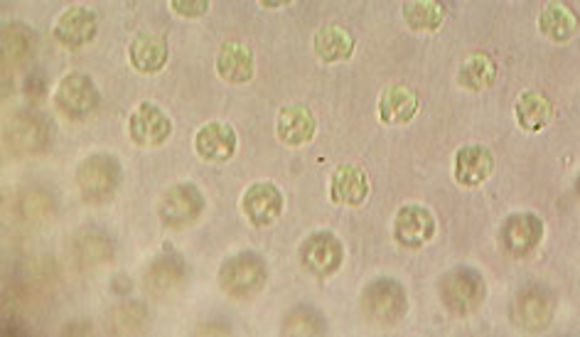 Image of <i>Volvox aureus</i>