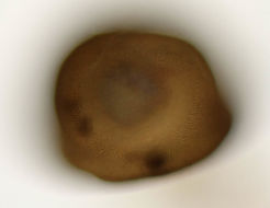 Image of <i>Arcella vulgaris</i>