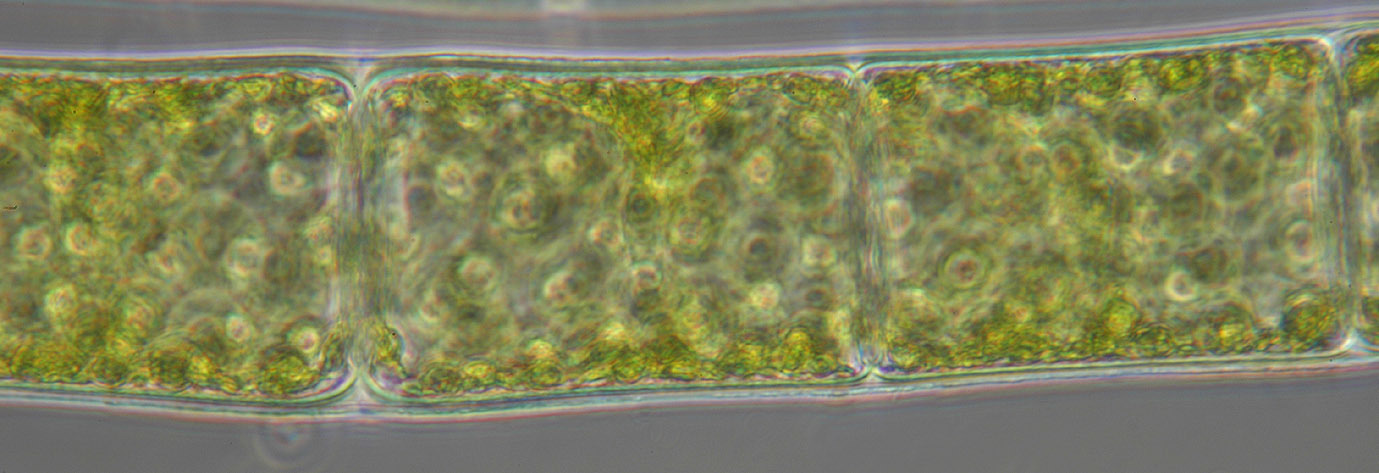 Image of Spirogyra majuscula