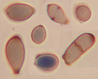 cladosporium sphaerospermum