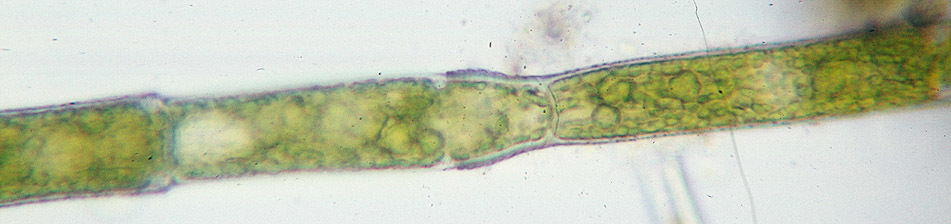 oedogonium under microscope labeled