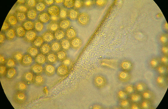 Image of <i>Hemitrichia clavata</i>