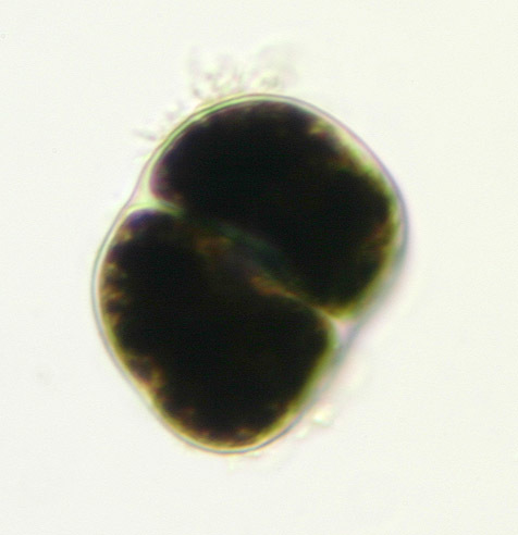 Image of <i>Chlorochytrium lemnae</i>