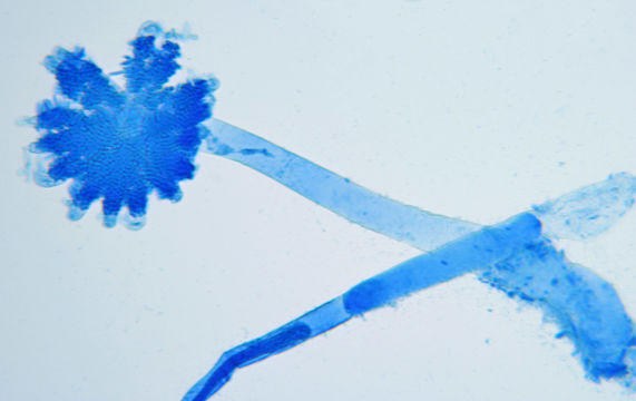 Image of <i>Kickxella alabastrina</i> Coem. 1862