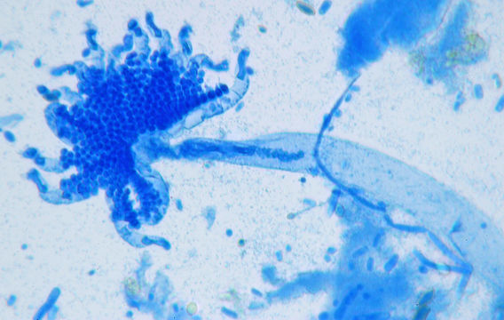 Image of <i>Kickxella alabastrina</i> Coem. 1862