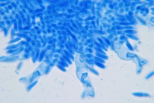 Image of <i>Kickxella alabastrina</i> Coem. 1862