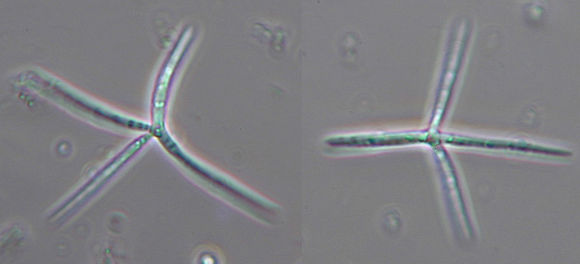 Image of <i>Alatospora acuminata</i> Ingold 1942