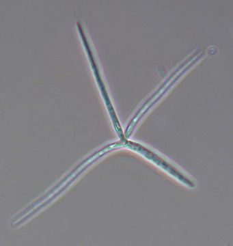 Image of <i>Alatospora acuminata</i> Ingold 1942