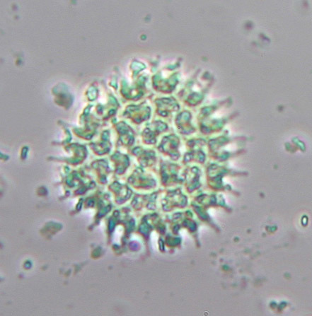 Image of <i>Pseudopediastrum boryanum</i>