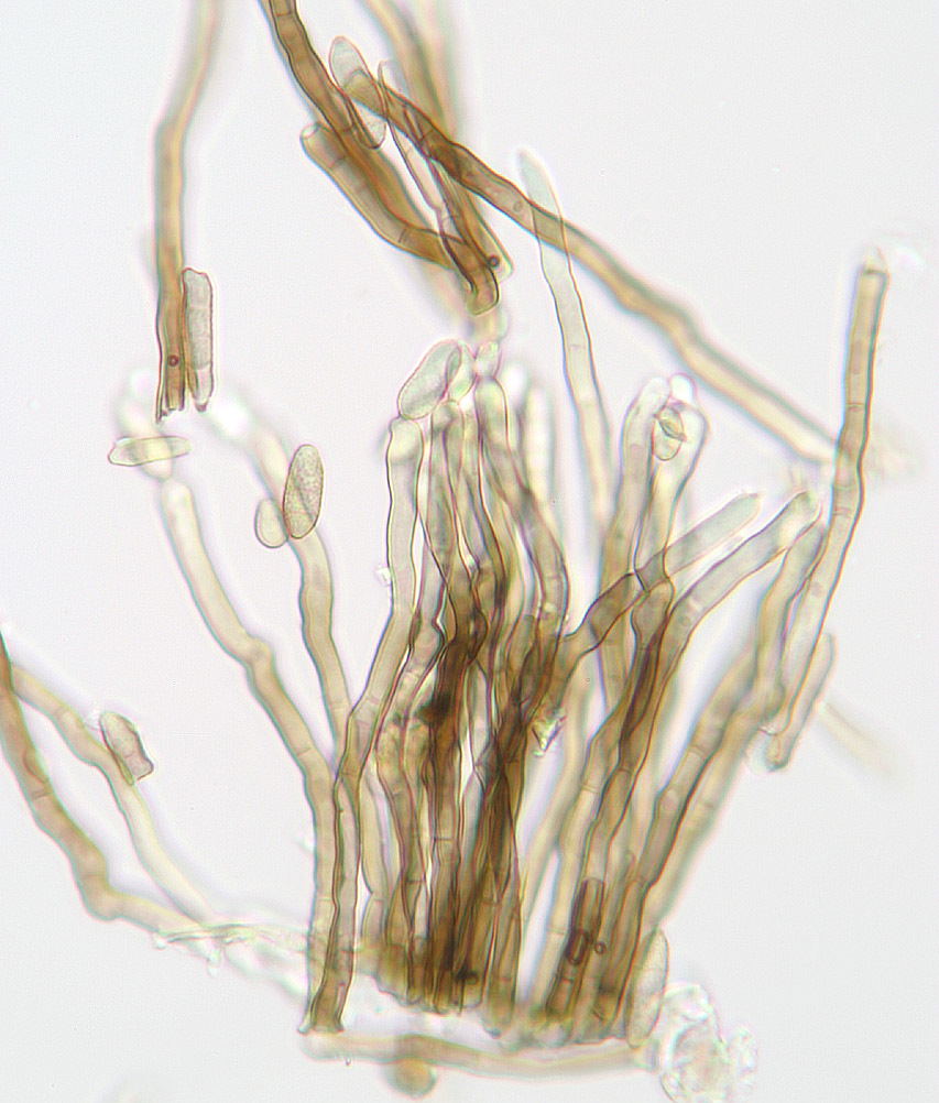 Image of Cladosporium macrocarpum Preuss 1848