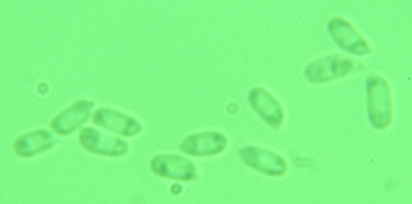 Image of <i>Scopuloides rimosa</i> (Cooke) Jülich 1982