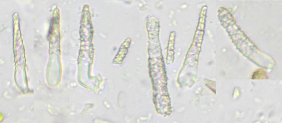 Image of <i>Scopuloides rimosa</i> (Cooke) Jülich 1982