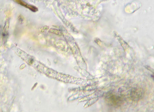 Image of <i>Scopuloides rimosa</i> (Cooke) Jülich 1982