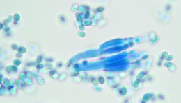 Image of Penicillium