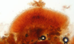 Image of Tuberculina persicina (Ditmar) Sacc. 1881