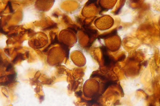 Image of <i>Bartheletia paradoxa</i> G. Arnaud ex Scheuer, R. Bauer, M. Lutz, Stabenth., Melnik & Grube 2008