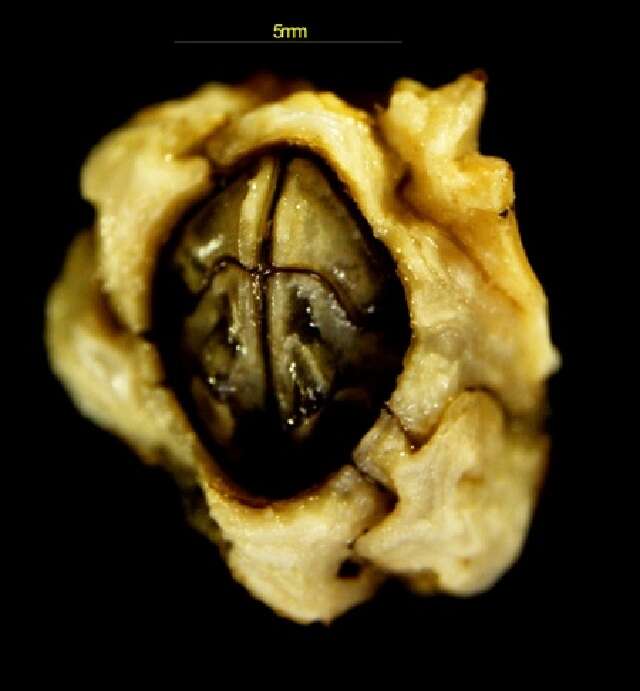 Image of Notochthamalus Foster & Newman 1987