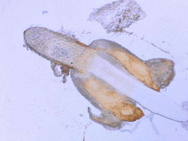 Image of Echinorhynchidae