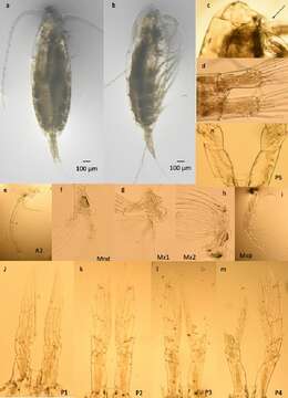 Image of Calanoides Brady 1883