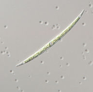 Image of Closterium Nitzsch ex Ralfs 1848