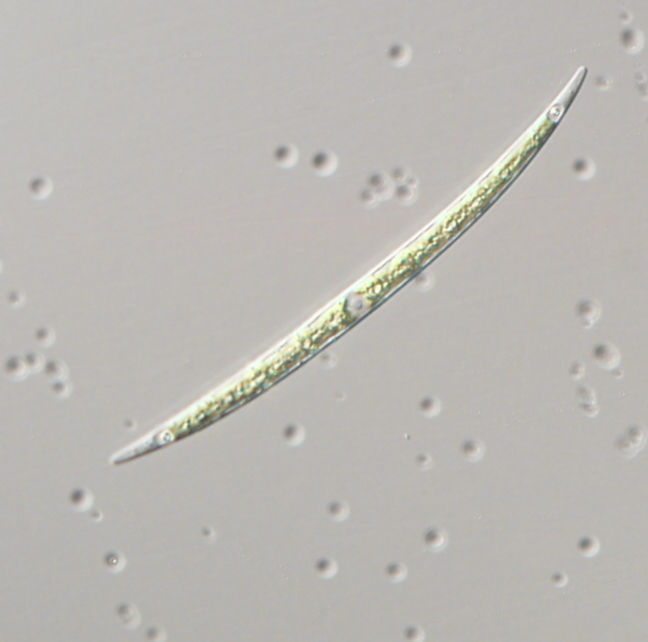 Image of Closterium Nitzsch ex Ralfs 1848