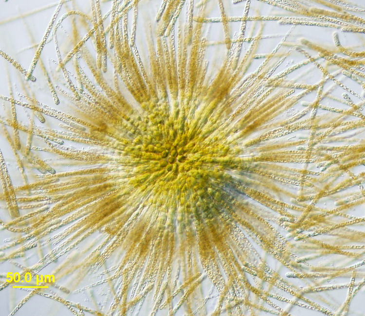 Image of Gloeotrichia echinulata