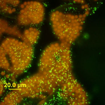 Imagem de Microcystis wesenbergii