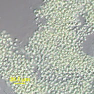 Image de Microcystis Lemmermann 1907
