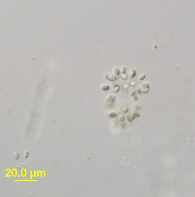 Image of <i>Snowella lacustris</i>