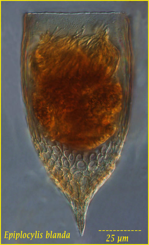 Image of Epiplocylis blanda (Jörgensen 1924) Kofoid & Campbell 1939