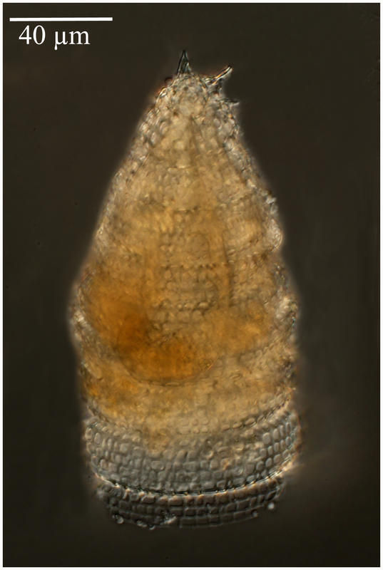 Image of Spirocyrtis scalaris Haeckel 1887