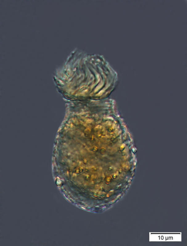 Image of Codonellopsis pusilla (Cleve) Jörgensen 1924