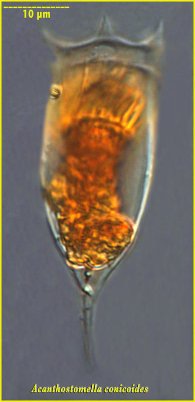 Image of Acanthostomella conicoides Kofoid & Campbell 1929